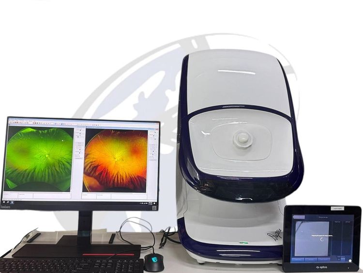 Optos Ultra widefield Daytona